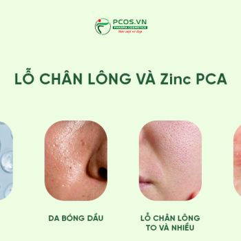 LỖ CHÂN LÔNG VÌ SAO NHÌN TO HƠN THEO THỜI GIAN?